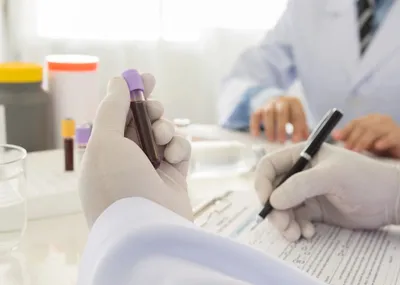 thick blood and paralysis risk  गाढ़ा खून बन सकता है पैरालिसिस का कारण  पतला करने के लिए क्या करें  जानिए डॉक्टर अवधेश पांडे से   
